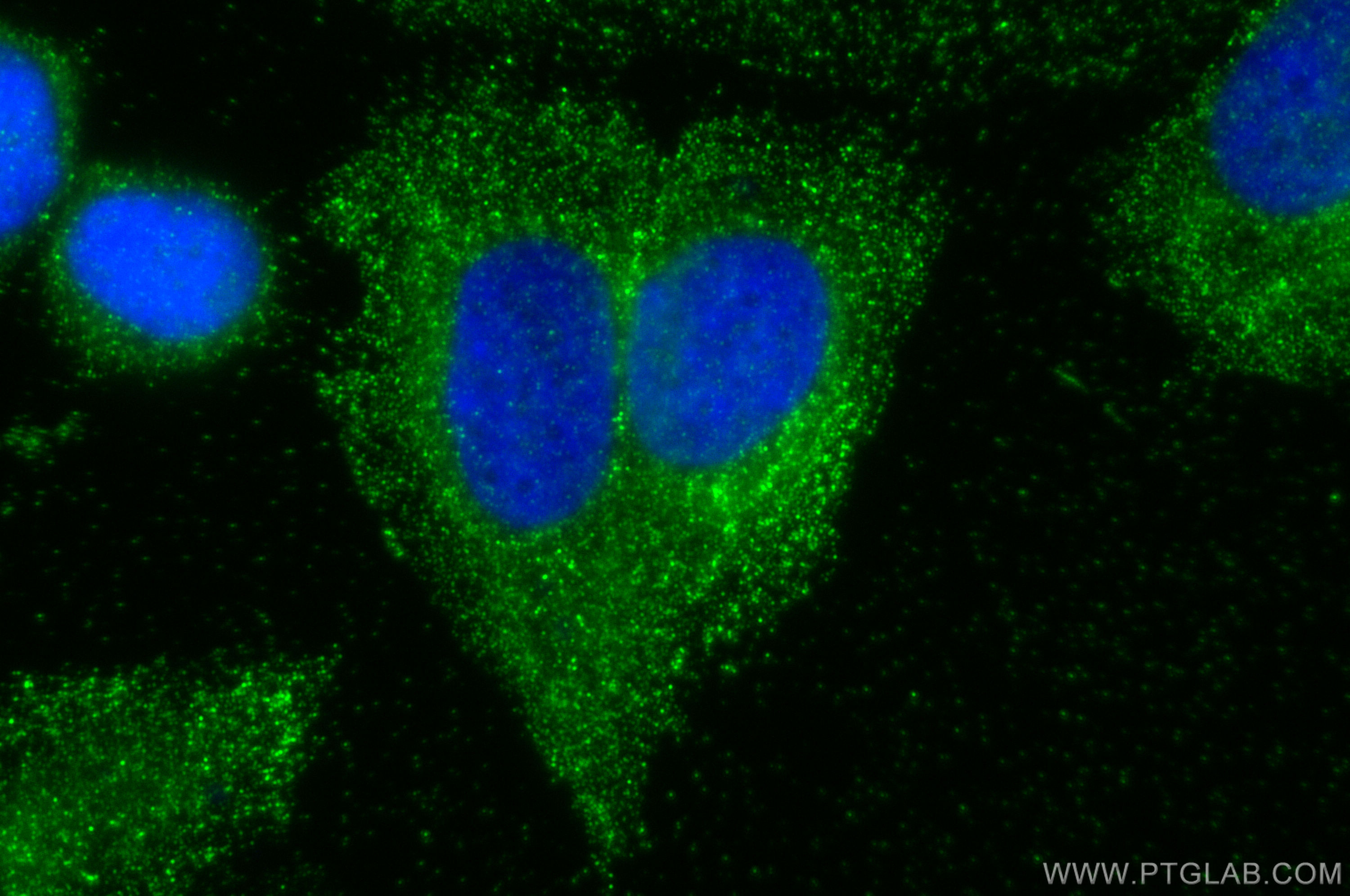 IF Staining of Saos-2 using 22213-1-AP