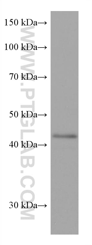 WB analysis of HaCaT using 67994-1-Ig (same clone as 67994-1-PBS)
