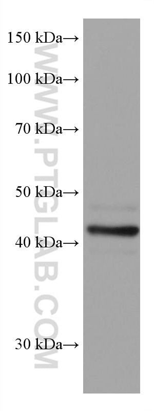 WB analysis of COLO 320 using 67994-1-Ig