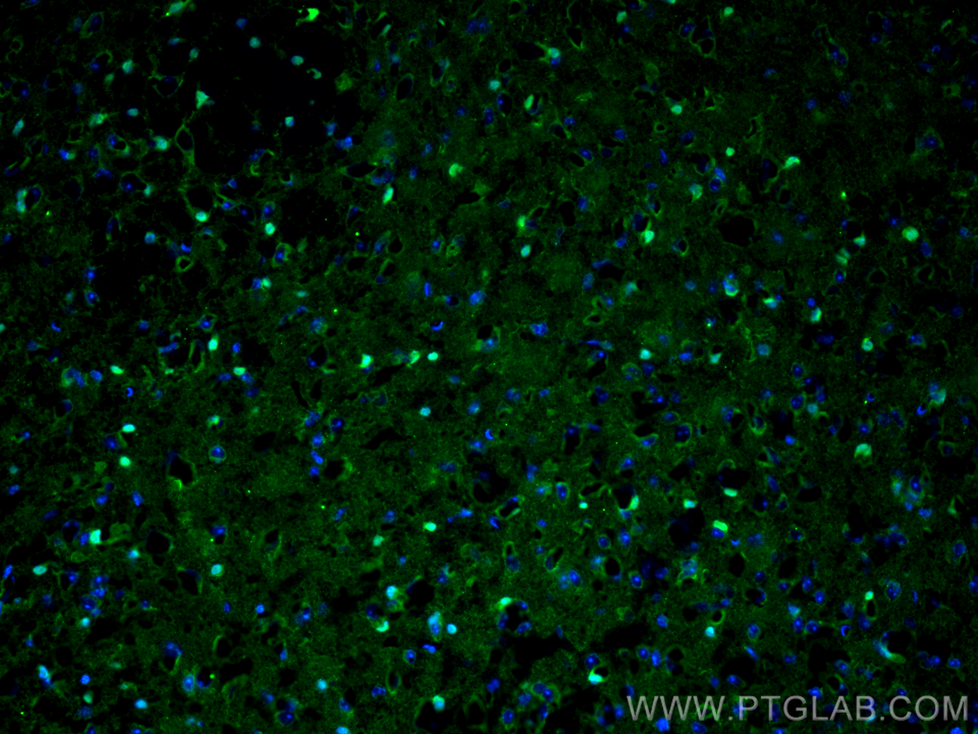 IF Staining of mouse brain using 10422-1-AP