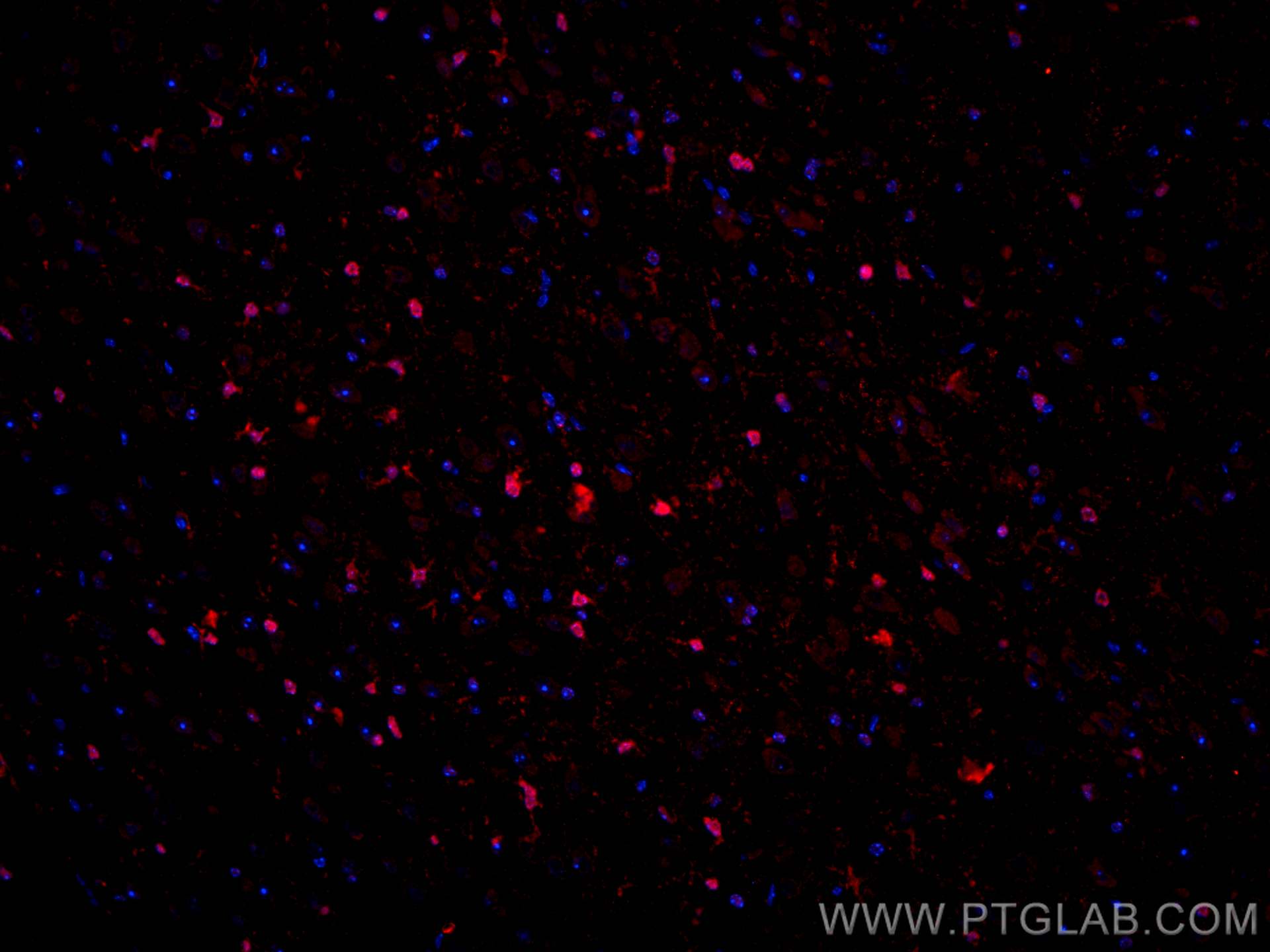 IF Staining of mouse brain using 11064-1-AP