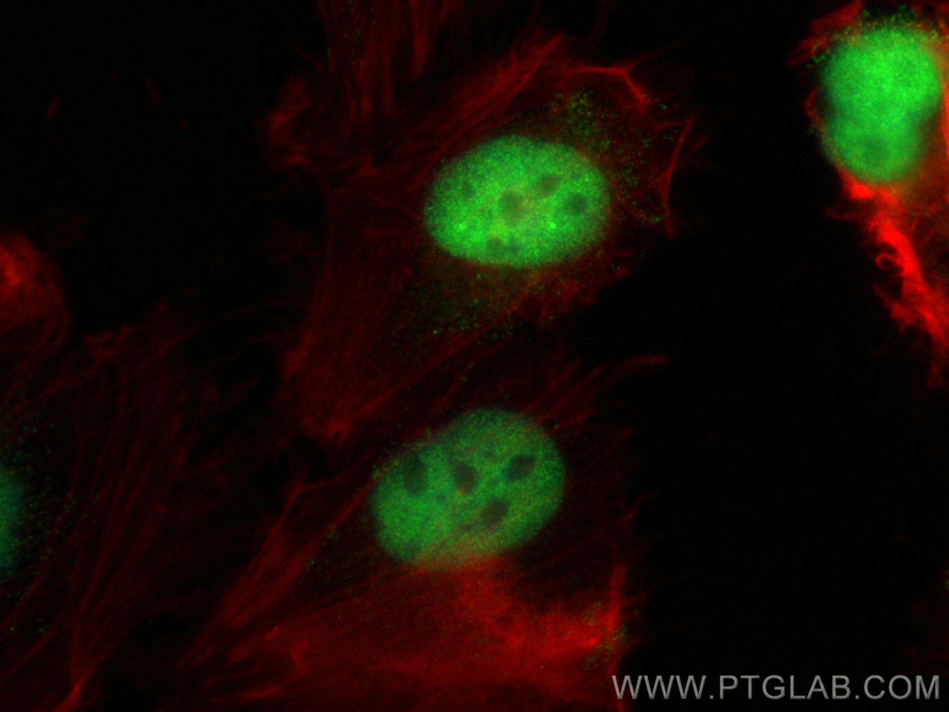 IF Staining of U-251 using 11064-1-AP