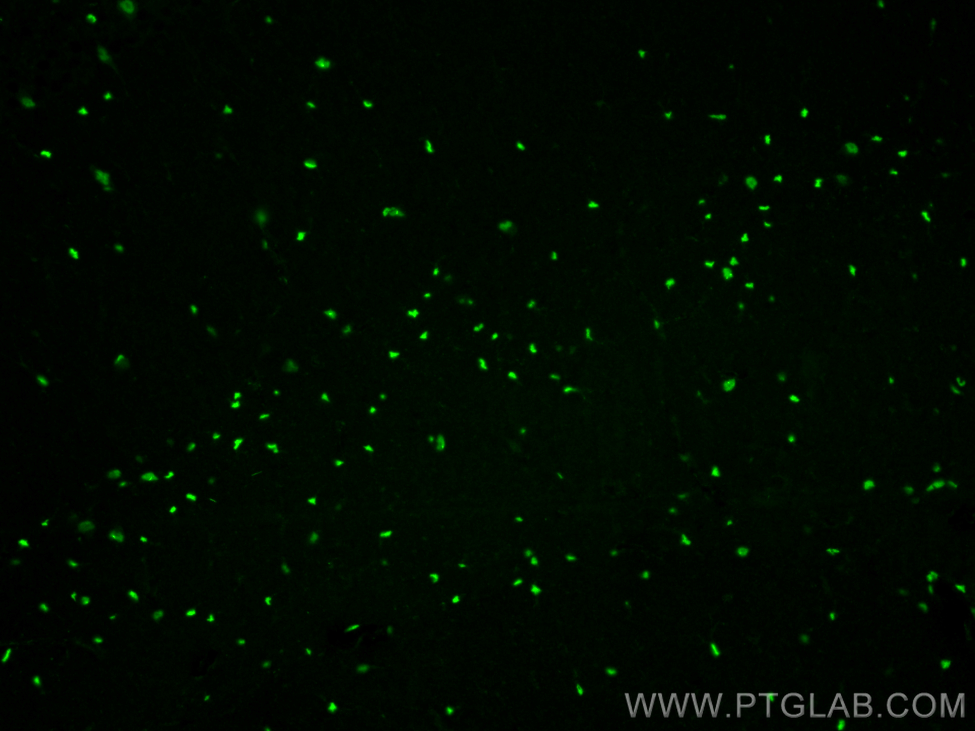 IF Staining of mouse brain using 11064-1-AP