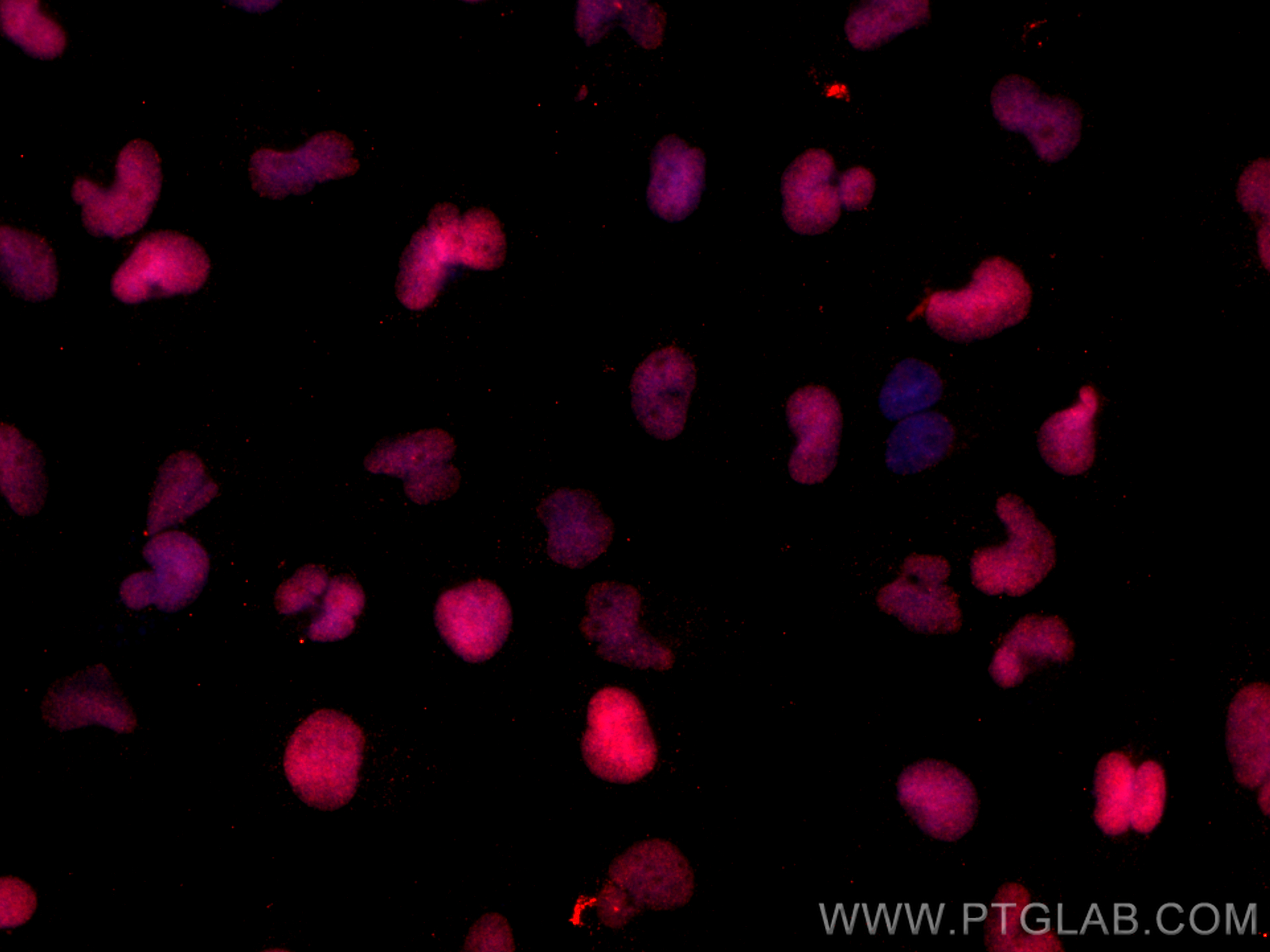 IF Staining of U-251 using CL594-66411