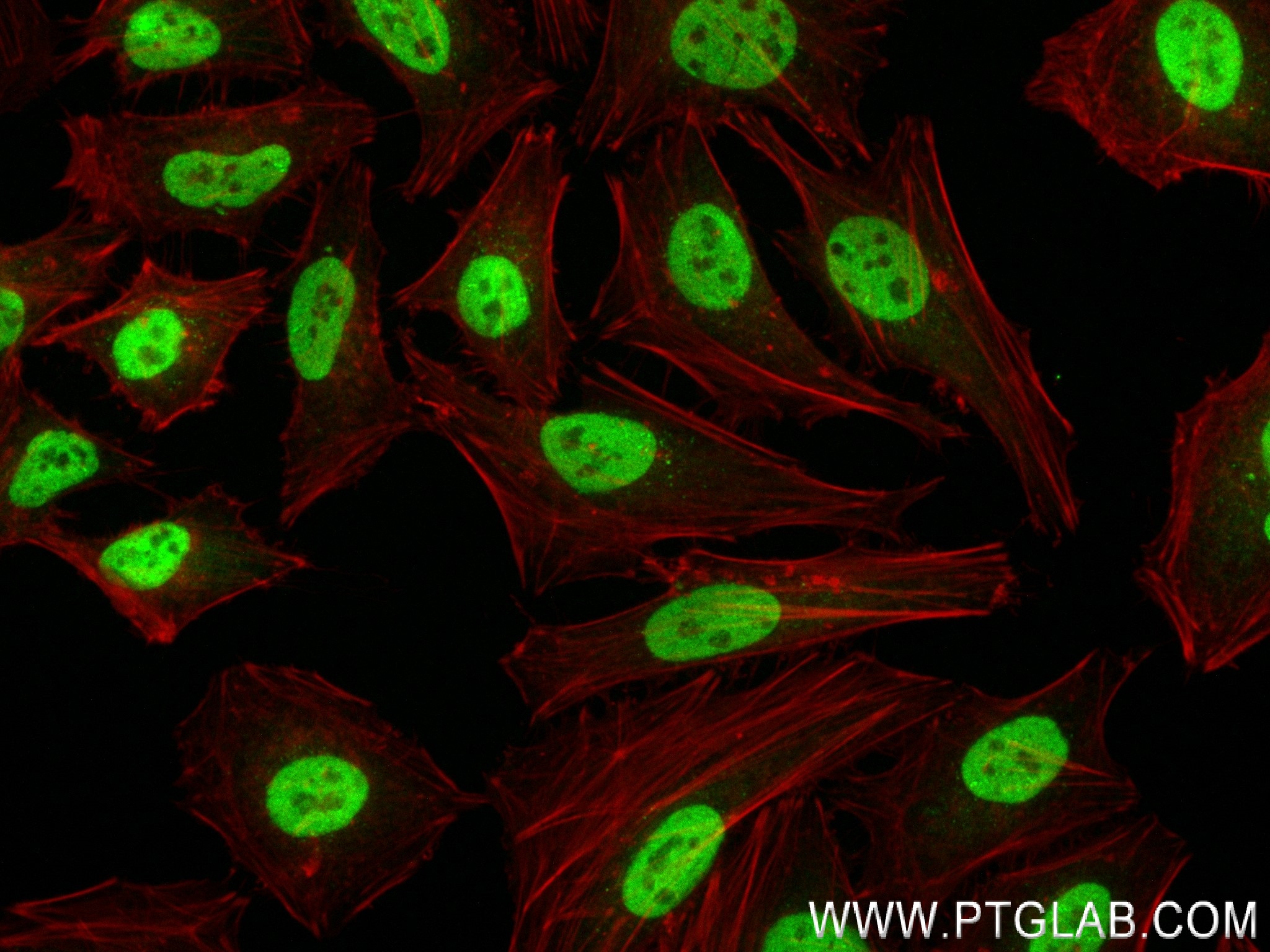 IF Staining of HeLa using 83238-3-RR