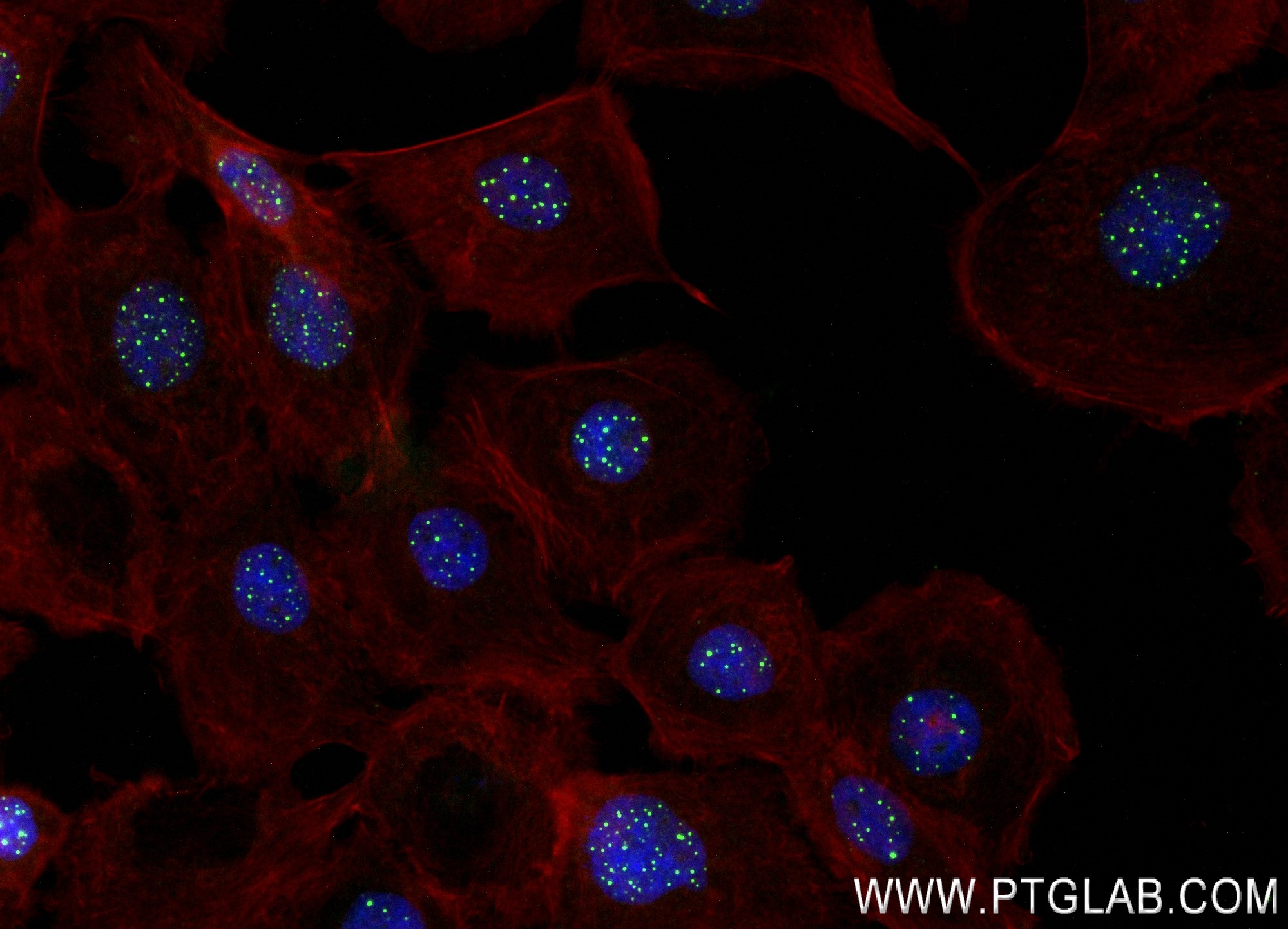 IF Staining of A431 using 84012-5-RR (same clone as 84012-5-PBS)