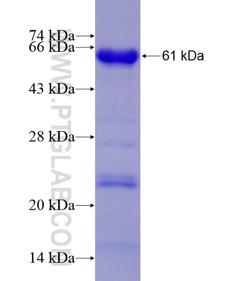 SP100 fusion protein Ag28524 SDS-PAGE