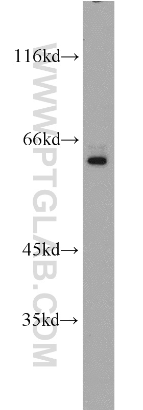 WB analysis of HeLa using 11502-1-AP