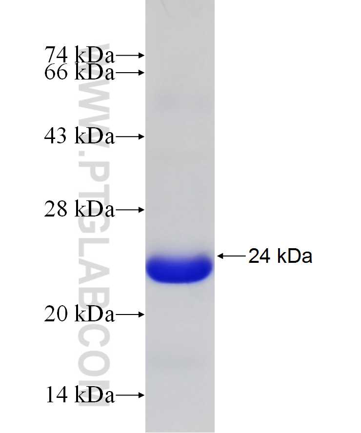 SP7 fusion protein Ag29889 SDS-PAGE