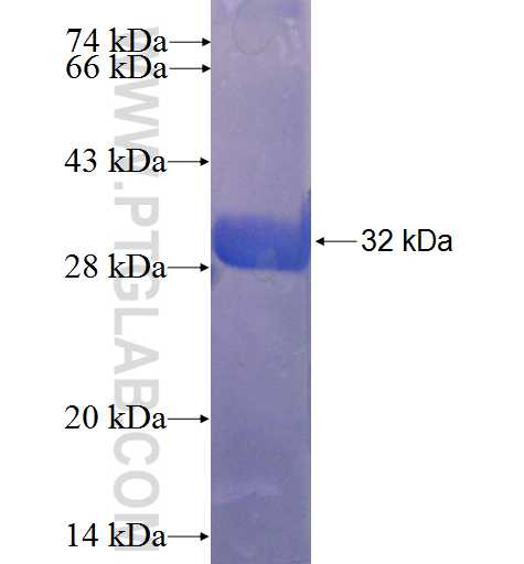 SP8 fusion protein Ag22977 SDS-PAGE