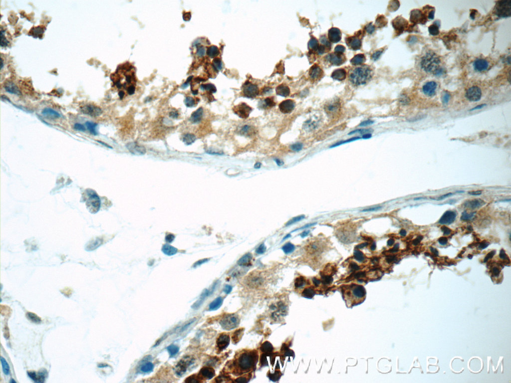 IHC staining of human testis using 12829-1-AP