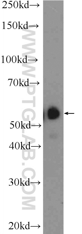 WB analysis of human testis using 19721-1-AP