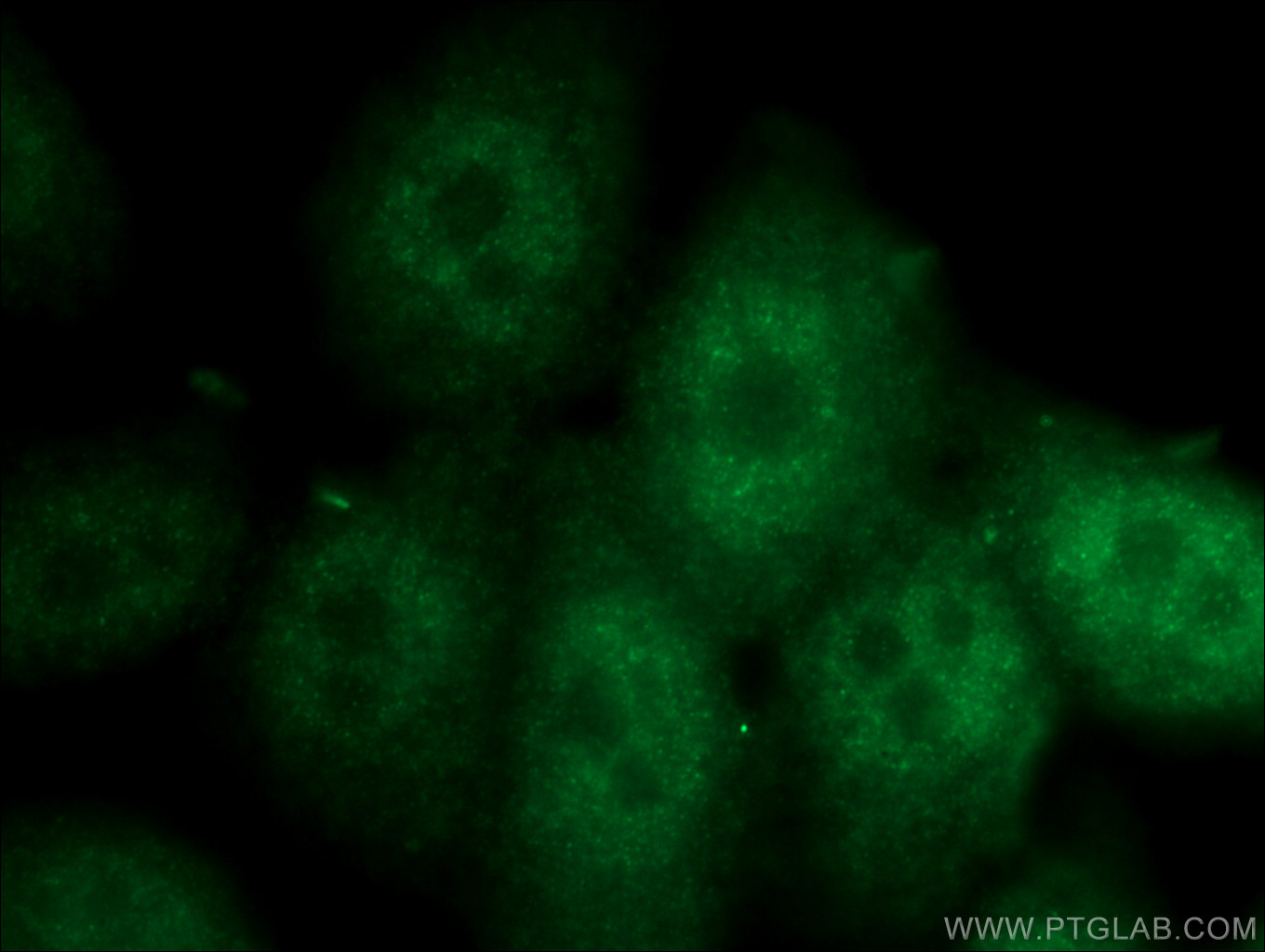 IF Staining of PC-3 using 17495-1-AP