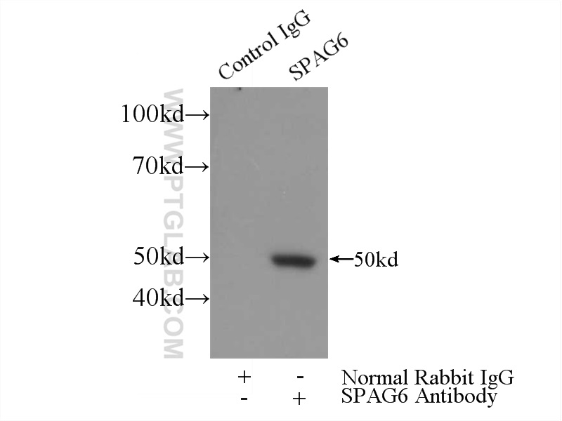 IP experiment of mouse testis using 12462-1-AP