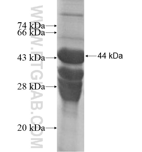 SPANXB1 fusion protein Ag10905 SDS-PAGE