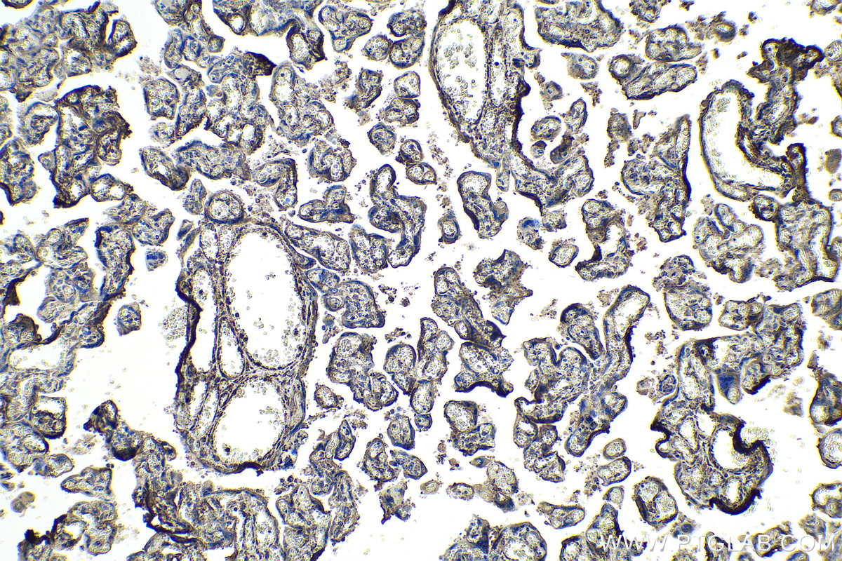 IHC staining of human placenta using 66426-1-Ig (same clone as 66426-1-PBS)