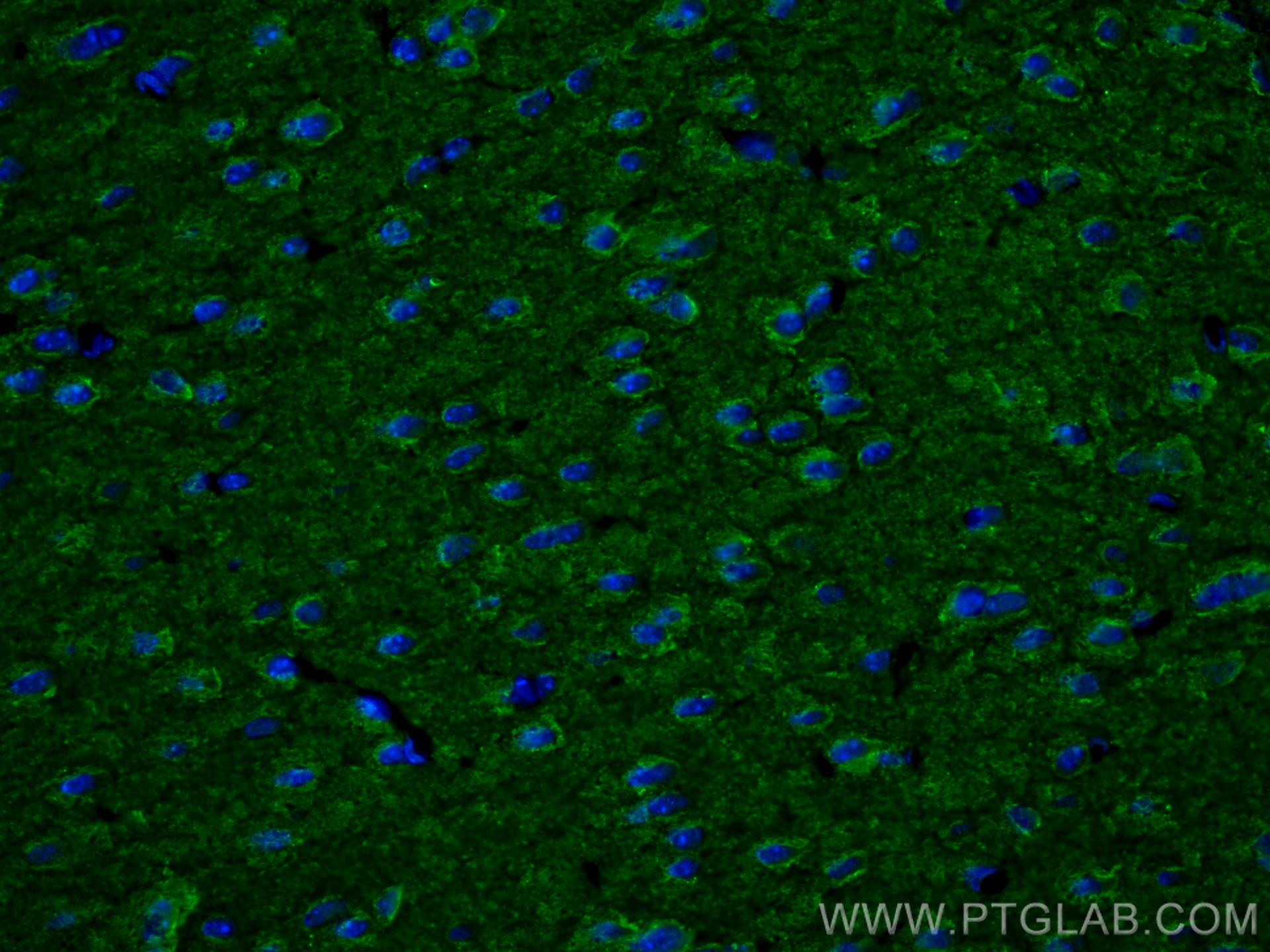 IF Staining of mouse brain using 67361-1-Ig (same clone as 67361-1-PBS)
