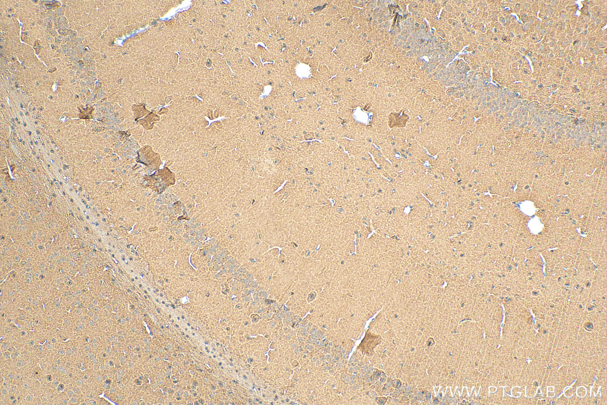 IHC staining of mouse brain using 67361-1-Ig (same clone as 67361-1-PBS)