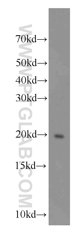 WB analysis of human testis using 16656-1-AP