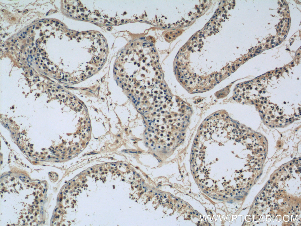 IHC staining of human testis using 11849-1-AP