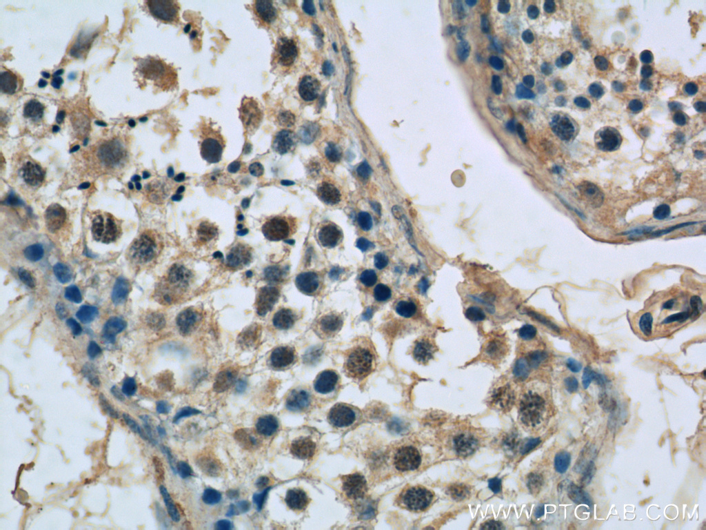 IHC staining of human testis using 11849-1-AP