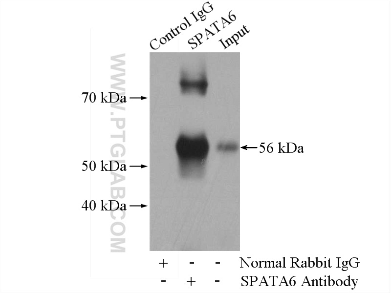 IP experiment of mouse testis using 11849-1-AP