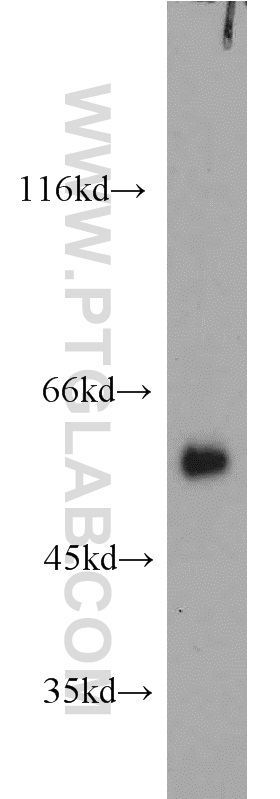 WB analysis of mouse testis using 11849-1-AP