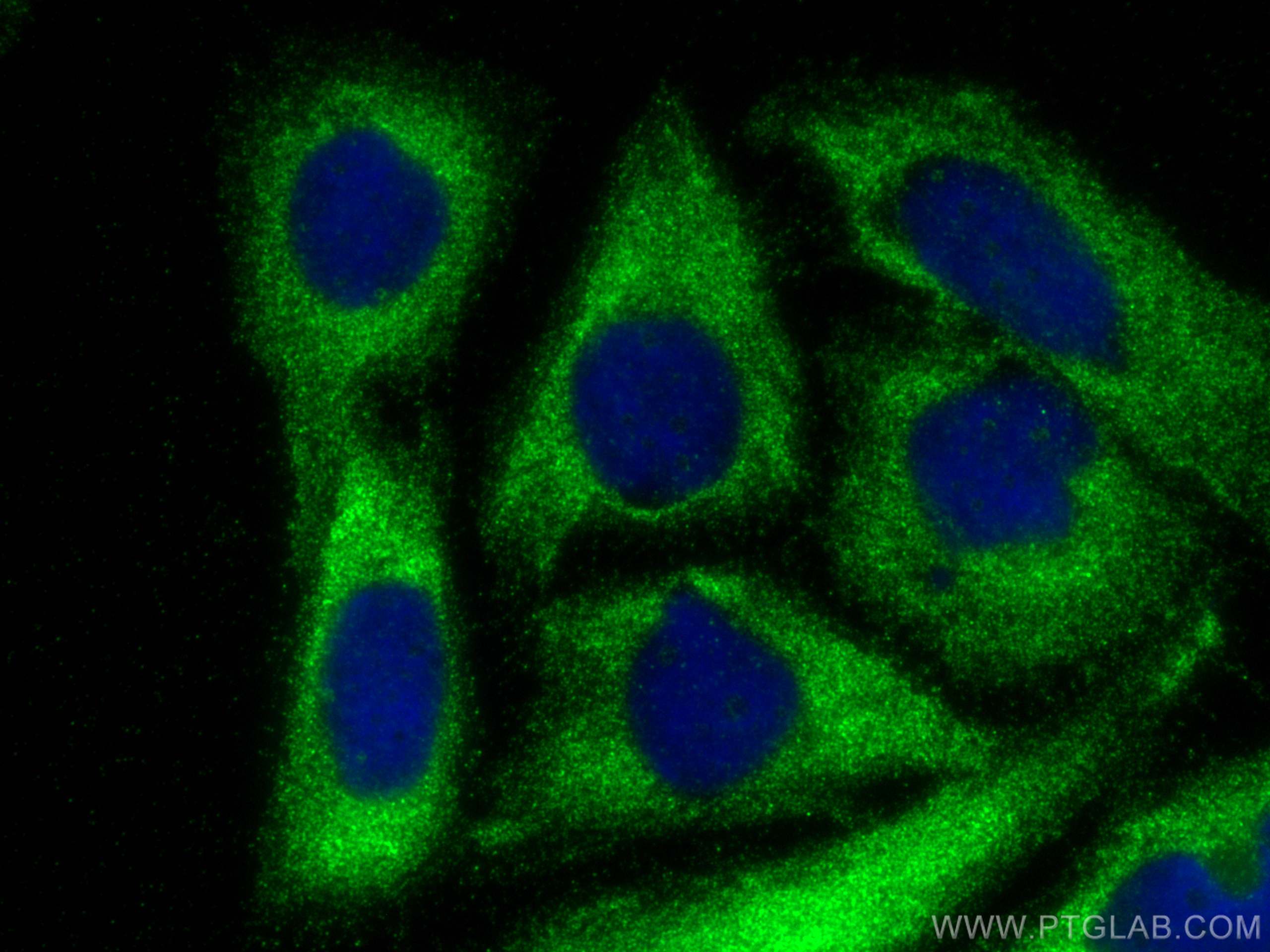 IF Staining of Saos-2 using 16938-1-AP