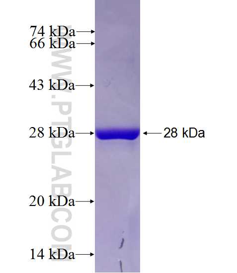 SPC24 fusion protein Ag28039 SDS-PAGE