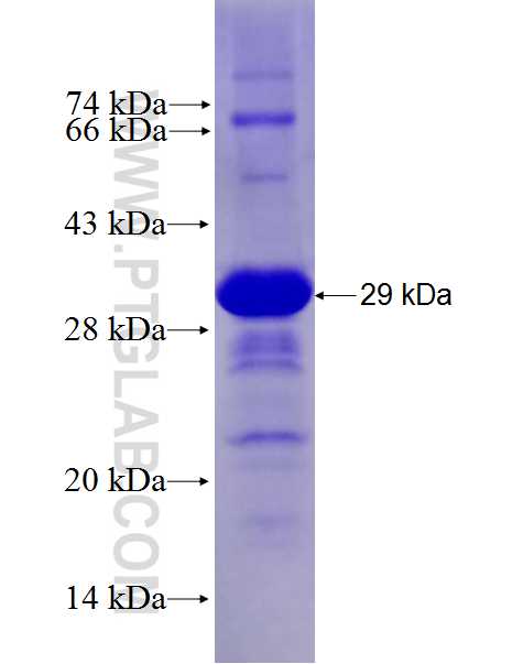 SPESP1 fusion protein Ag27729 SDS-PAGE