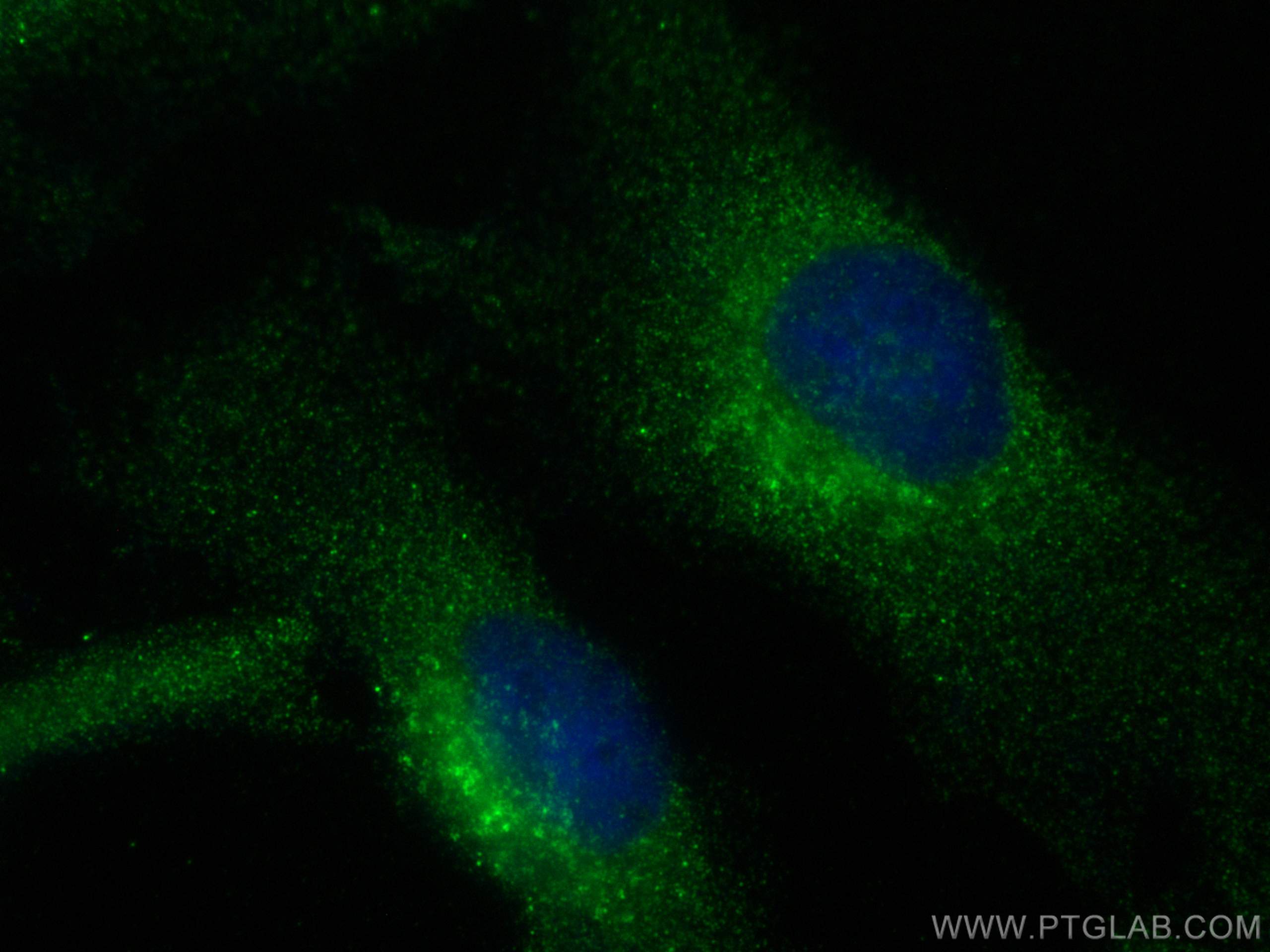 IF Staining of HeLa using 17096-1-AP