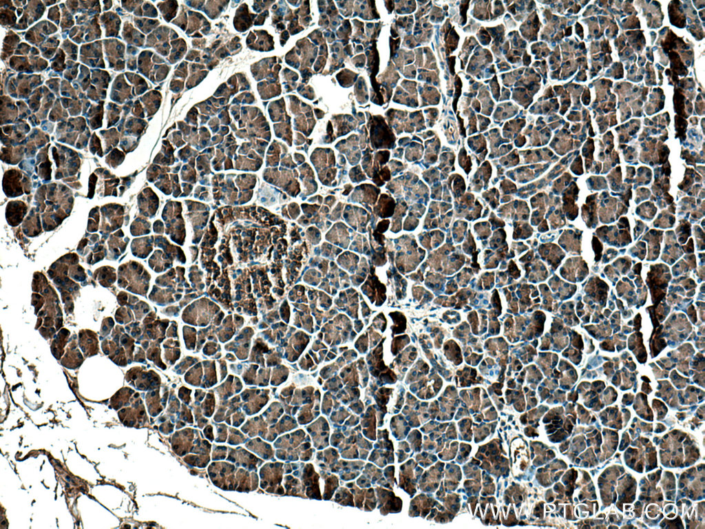 IHC staining of human pancreas using 13477-1-AP