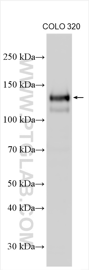 WB analysis of COLO 320 using 29808-1-AP