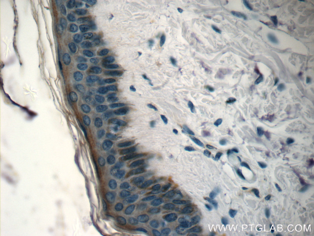 IHC staining of human skin using 24661-1-AP