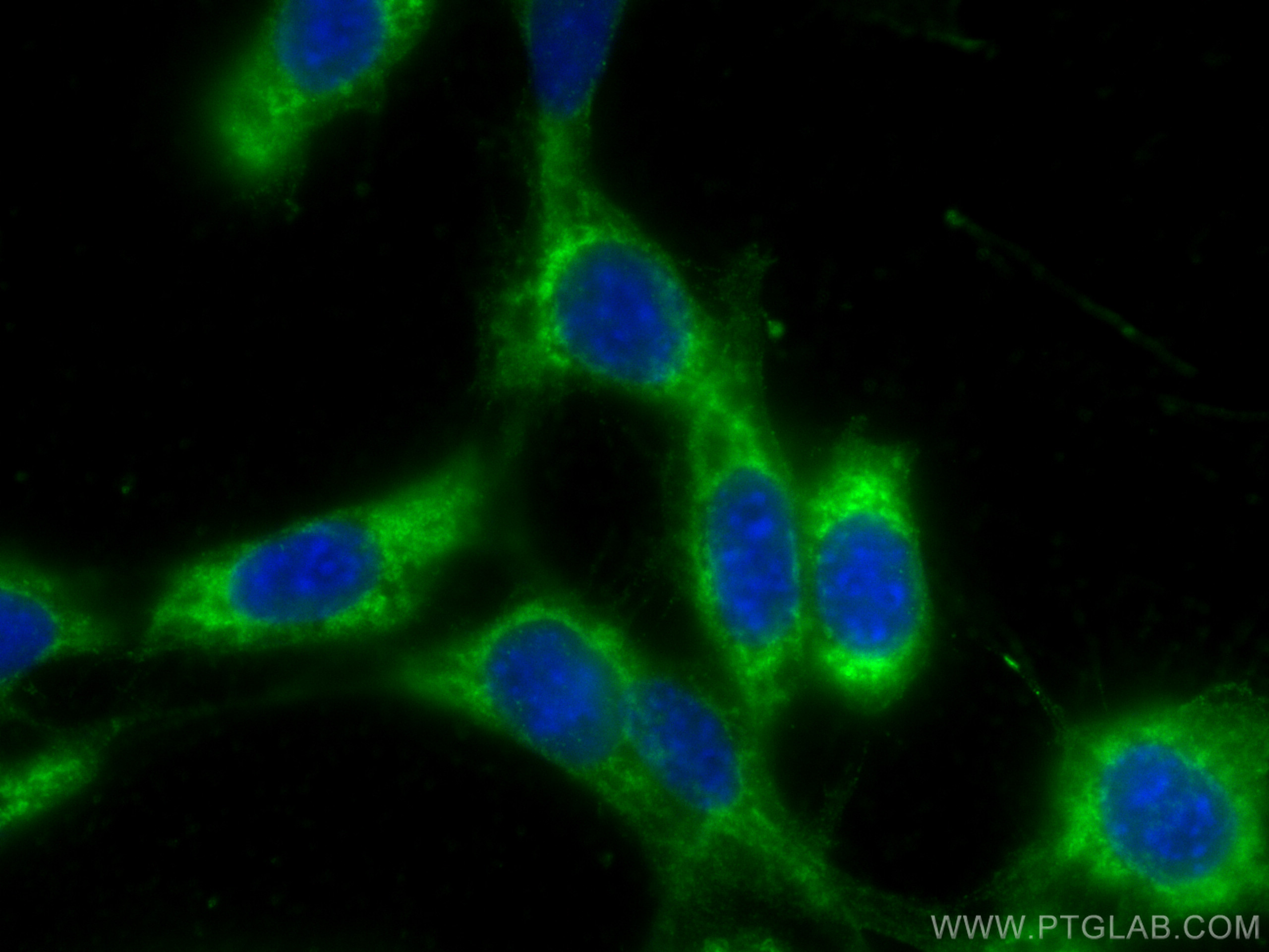 IF Staining of NIH/3T3 using 15036-1-AP