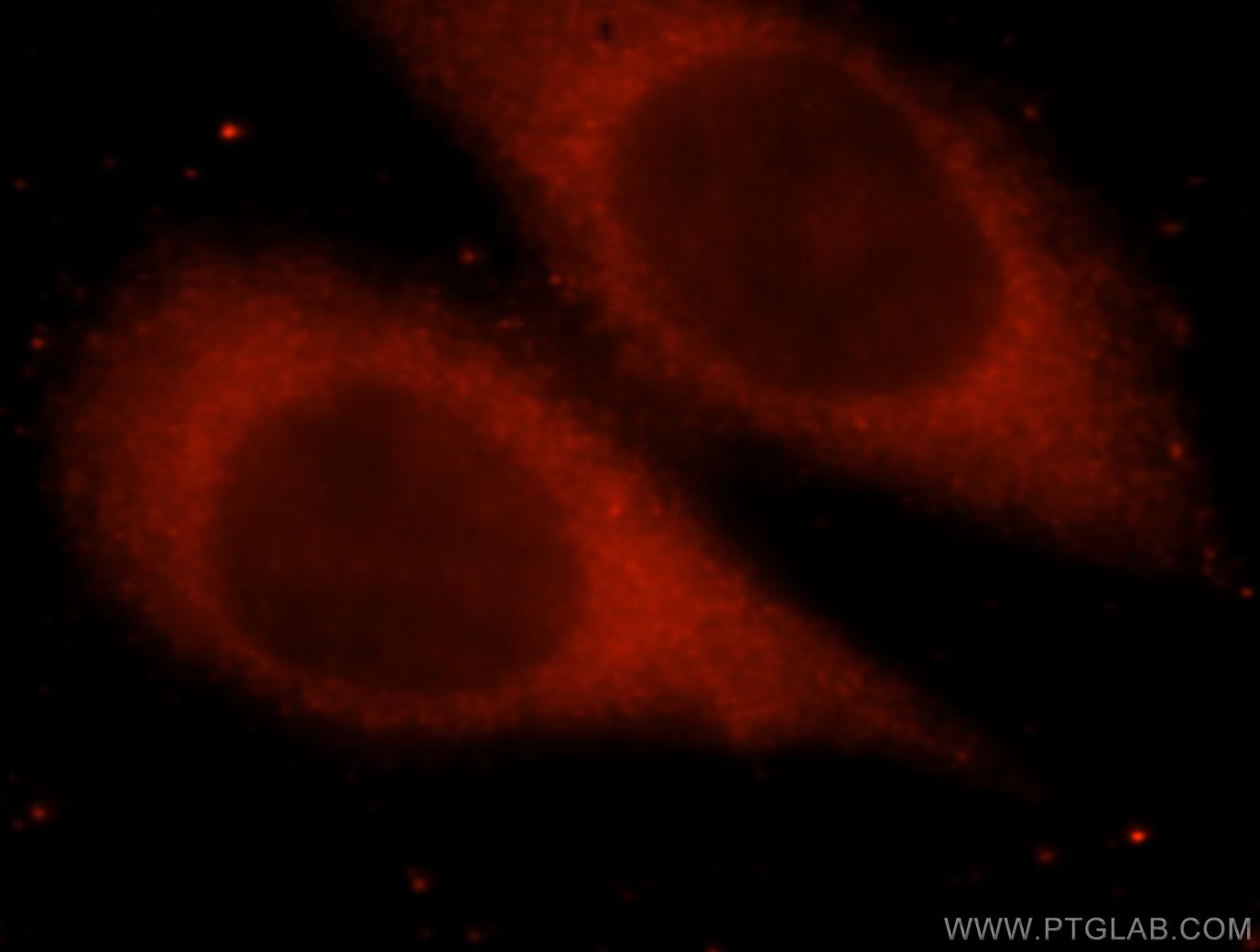 IF Staining of HeLa using 16822-1-AP