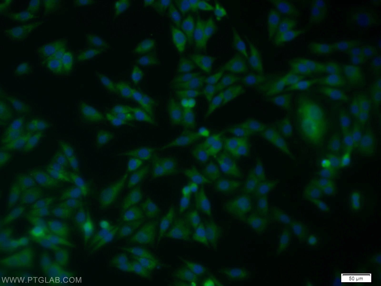 IF Staining of A375 using 11383-1-AP