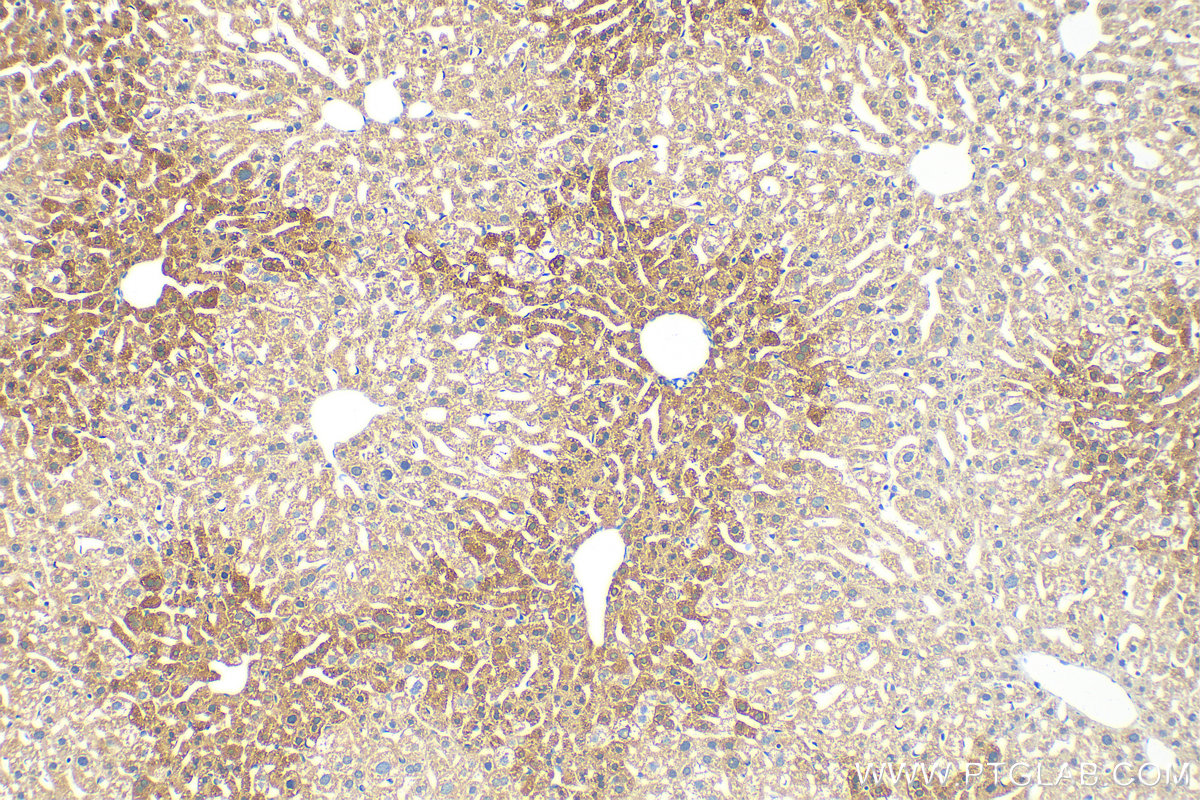 IHC staining of mouse liver using 22765-1-AP