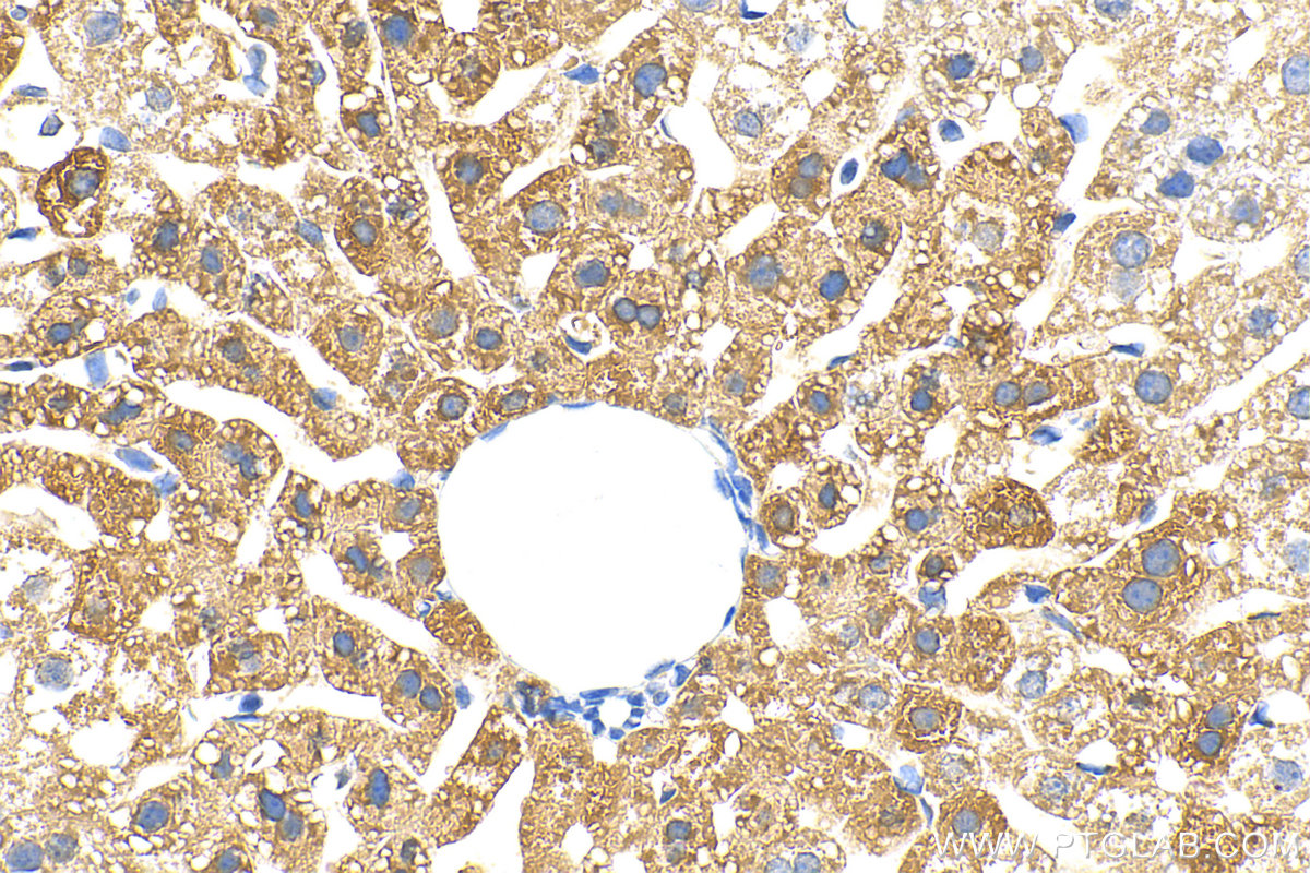 IHC staining of mouse liver using 22765-1-AP