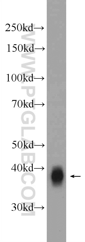 WB analysis of A375 using 22765-1-AP