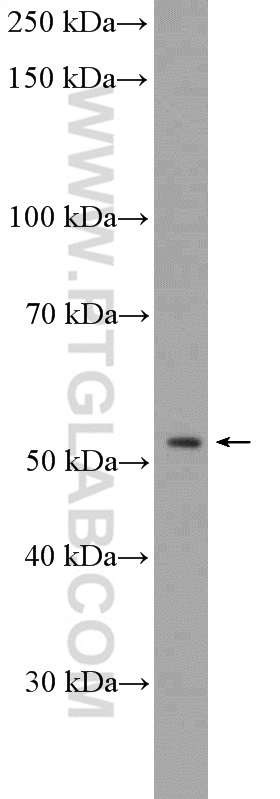 WB analysis of Jurkat using 20802-1-AP