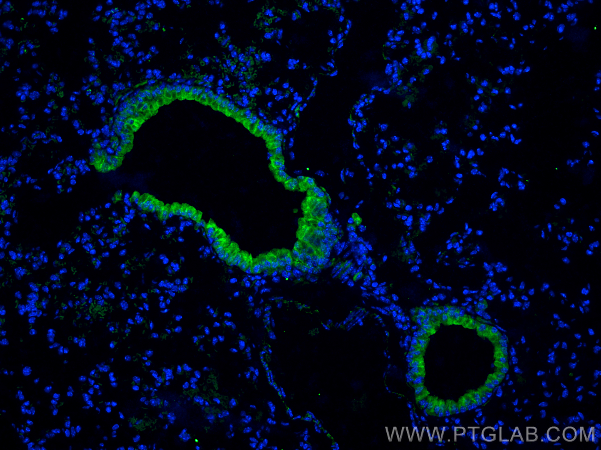 IF Staining of mouse lung using 55227-1-AP