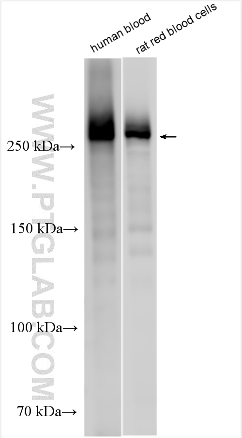 WB analysis using 55227-1-AP