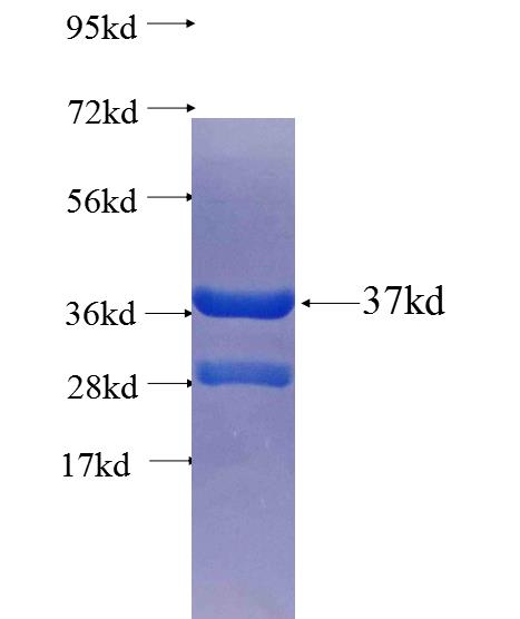 SPTB fusion protein Ag25614 SDS-PAGE