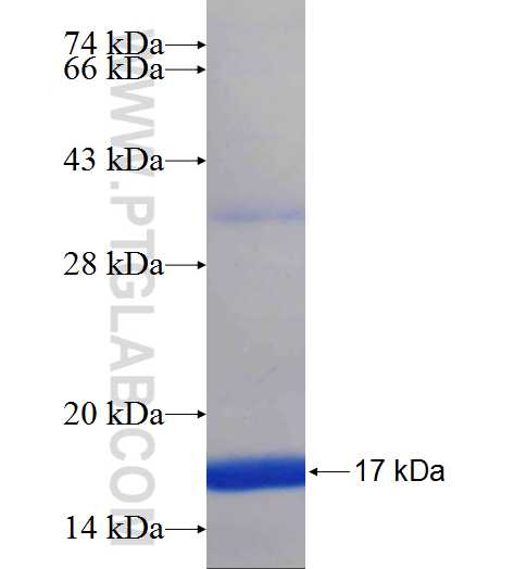 SPTB fusion protein Ag25629 SDS-PAGE