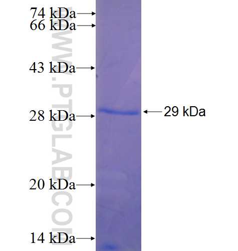 SPTBN1 fusion protein Ag22460 SDS-PAGE