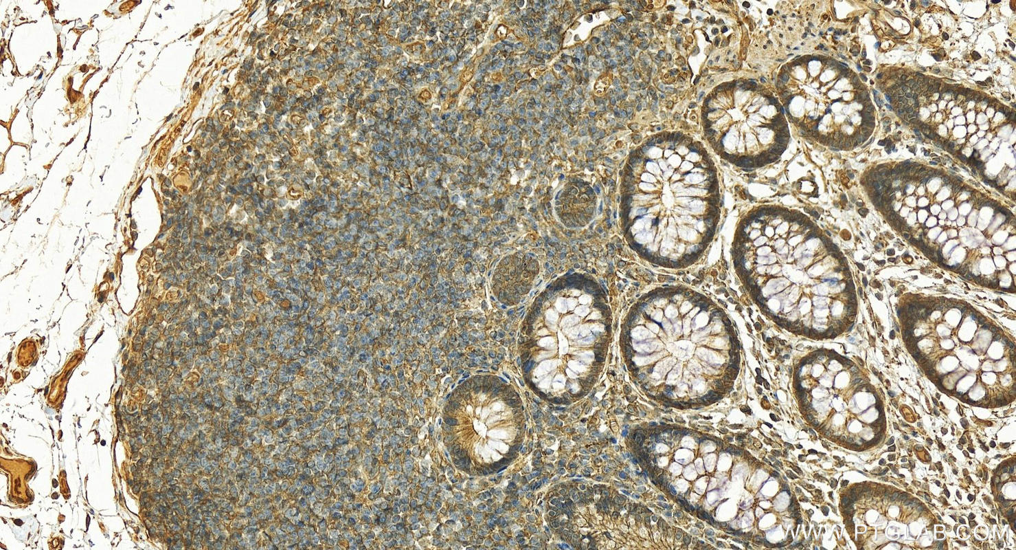 IHC staining of human normal colon using 19722-1-AP