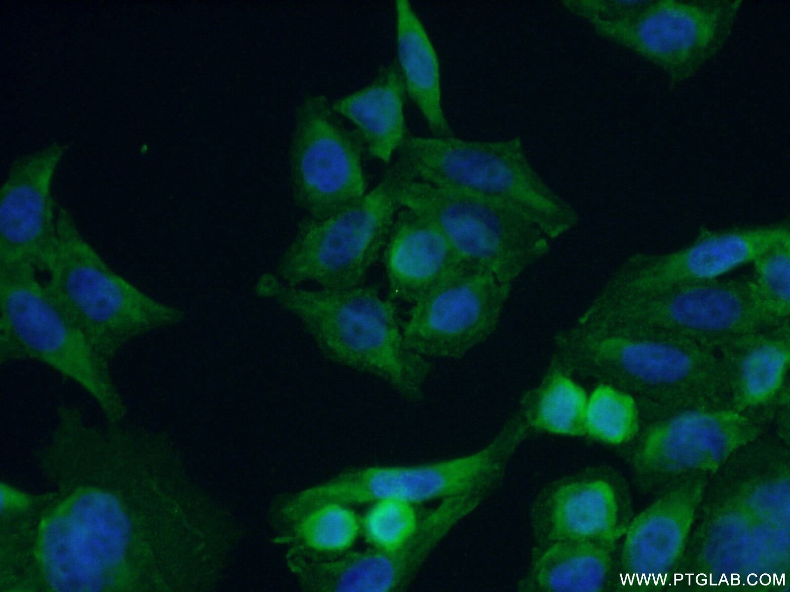 IF Staining of PC-3 using 18931-1-AP