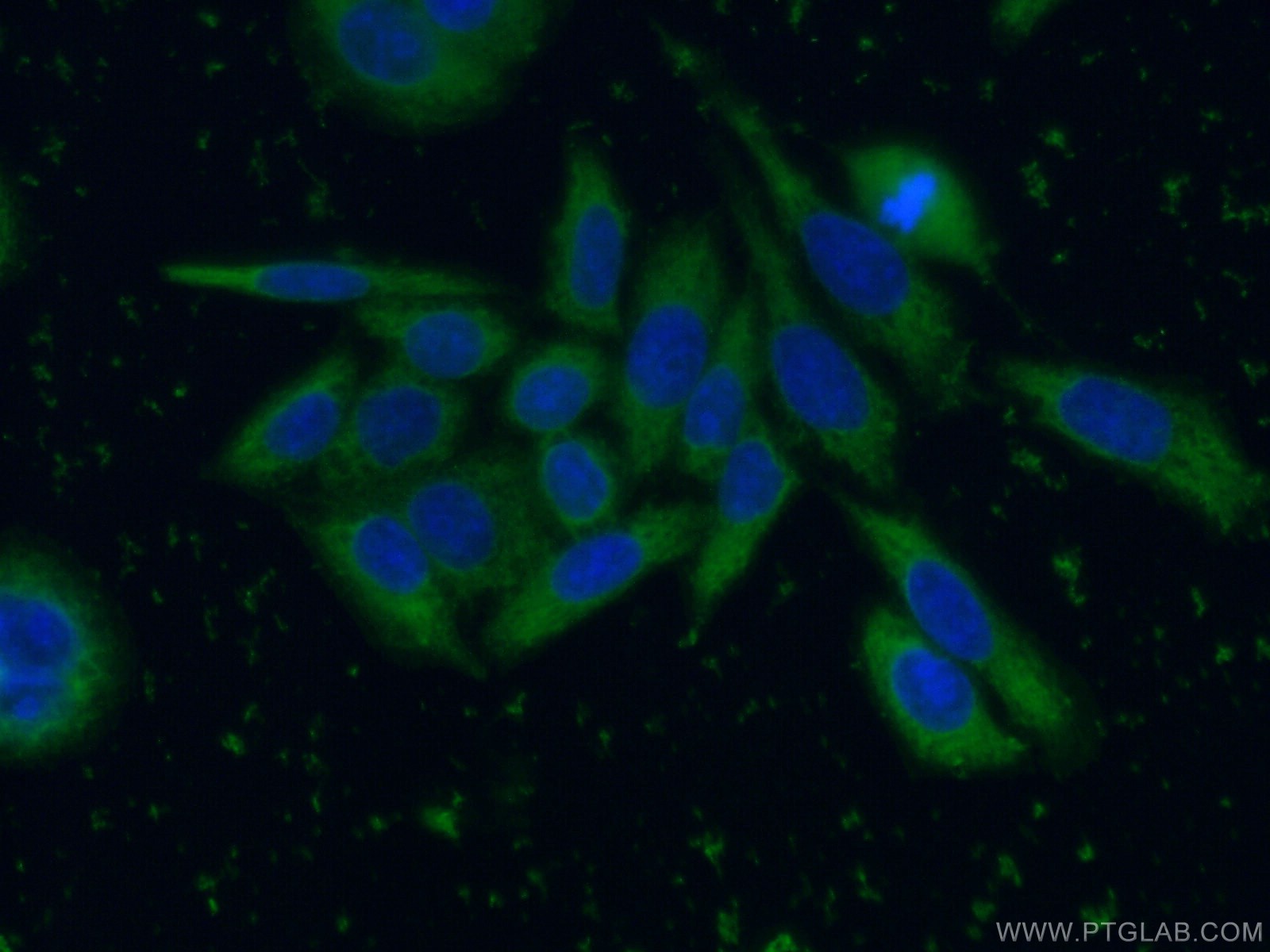 IF Staining of HeLa using 66329-1-Ig (same clone as 66329-1-PBS)