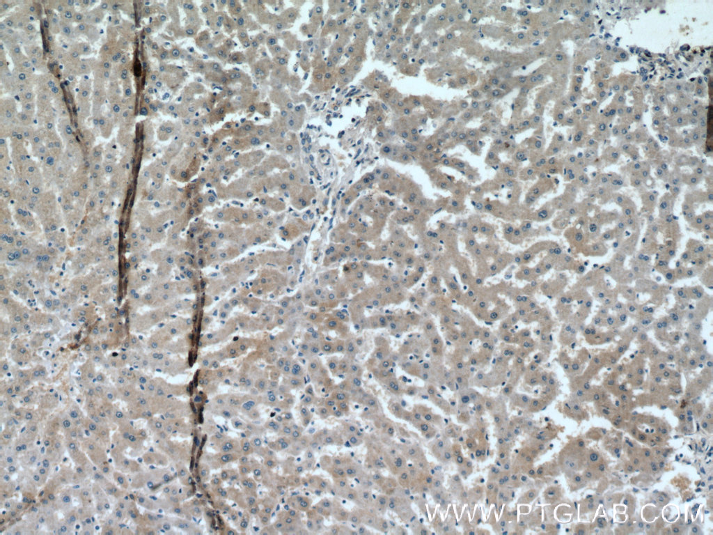 IHC staining of human liver using 66329-1-Ig (same clone as 66329-1-PBS)